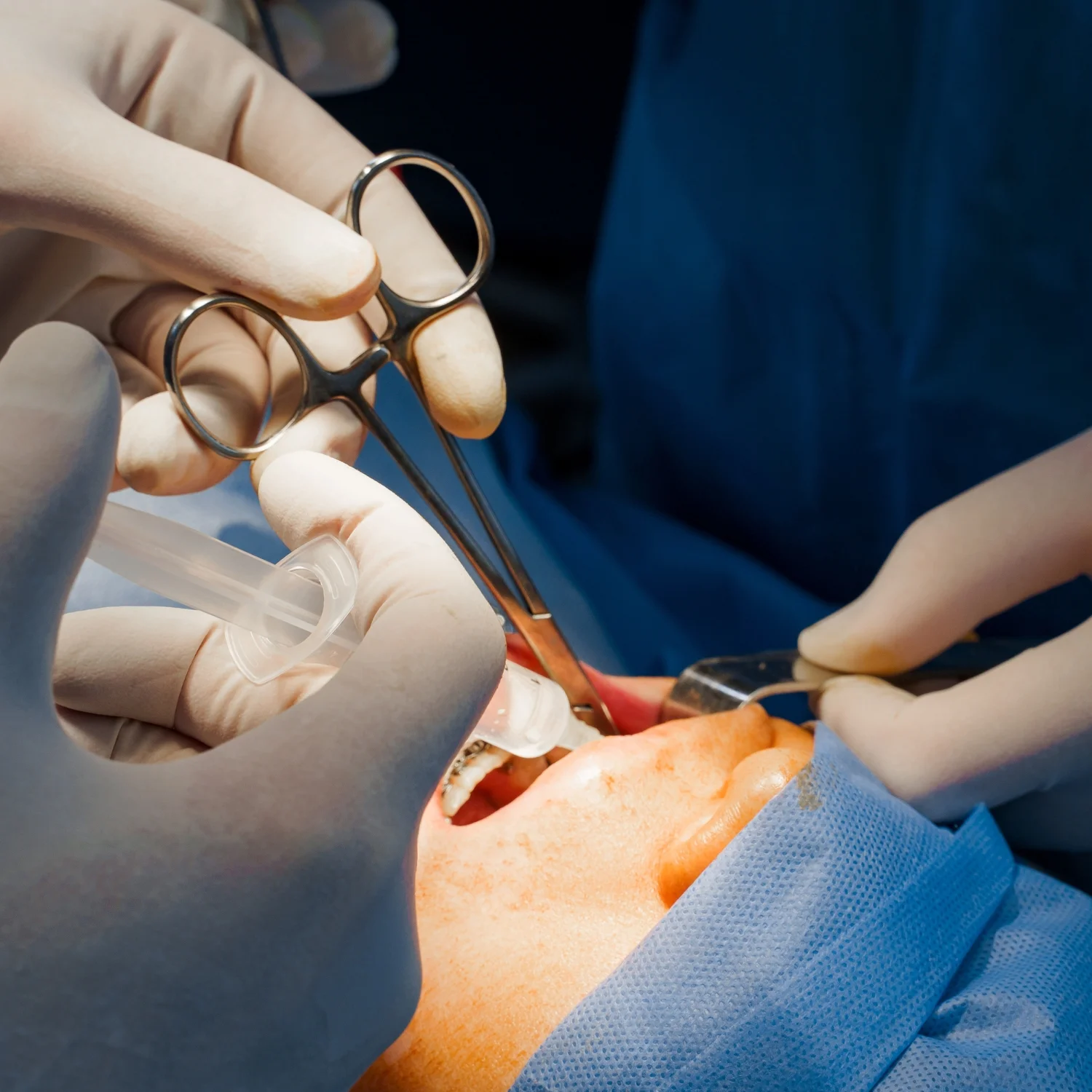 Best dental clinic in ongole